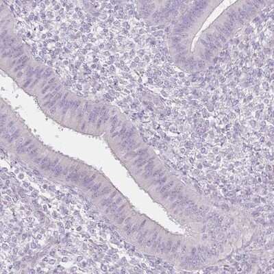 Immunohistochemistry-Paraffin: BORIS Antibody [NBP1-89947]