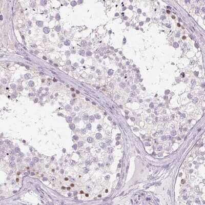 Immunohistochemistry-Paraffin: BORIS Antibody [NBP1-89947]