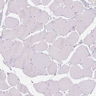 Immunohistochemistry-Paraffin: BORIS Antibody [NBP1-89947]