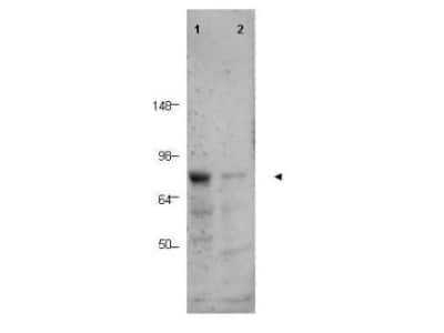 Western Blot: BORIS Antibody [NB100-2028]