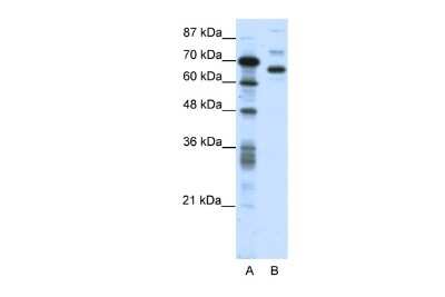 Western Blot: BORIS Antibody [NBP2-87076]