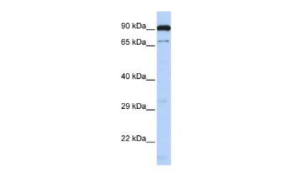 Western Blot: BORIS Antibody [NBP2-87077]