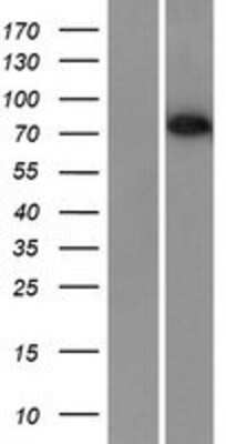 Western Blot: BORIS Overexpression Lysate [NBL1-09565]