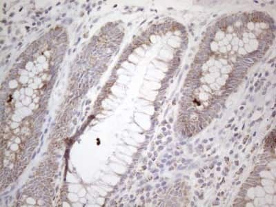 Immunohistochemistry: BP1 Antibody (OTI8A1) [NBP2-46463]