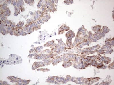 Immunohistochemistry: BP1 Antibody (OTI8A1) [NBP2-46463]