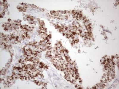 Immunohistochemistry: BP1 Antibody (OTI8A1) [NBP2-46463]