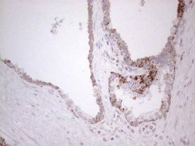 Immunohistochemistry: BP1 Antibody (OTI8A1) [NBP2-46463]
