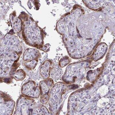 Immunohistochemistry-Paraffin: BP1 Antibody [NBP2-34130]