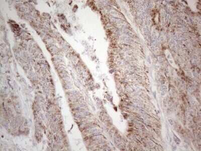 Immunohistochemistry: BP1 Antibody (OTI8A1) - Azide and BSA Free [NBP2-70581]