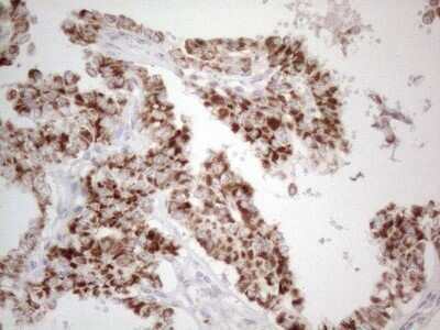 Immunohistochemistry: BP1 Antibody (OTI8A1) - Azide and BSA Free [NBP2-70581]