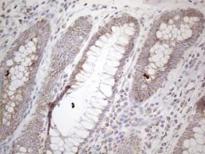 Immunohistochemistry: BP1 Antibody (OTI8A1) - Azide and BSA Free [NBP2-70581]