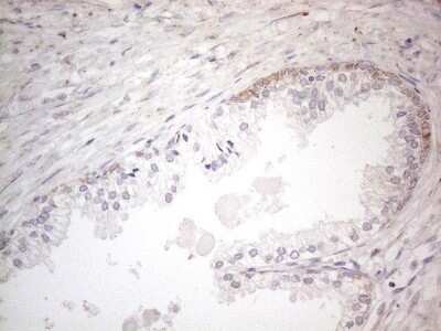 Immunohistochemistry: BP1 Antibody (OTI8A1) - Azide and BSA Free [NBP2-70581]