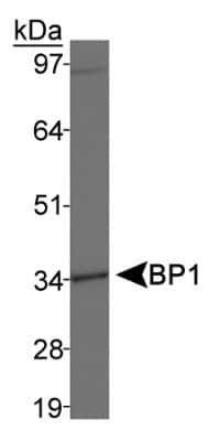 Western Blot: BP1 Antibody [NB100-481]