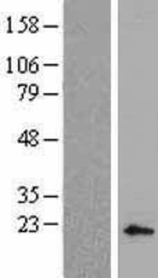 Western Blot: BP1 Overexpression Lysate [NBL1-09920]