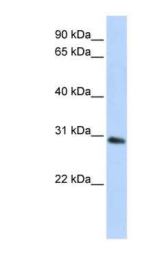 Western Blot: BPGM Antibody [NBP1-53186]