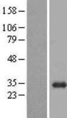 Western Blot: BPGM Overexpression Lysate [NBL1-08019]