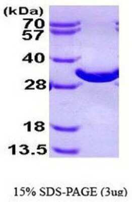 SDS-PAGE: Recombinant Human BPGM His Protein [NBP1-44485]