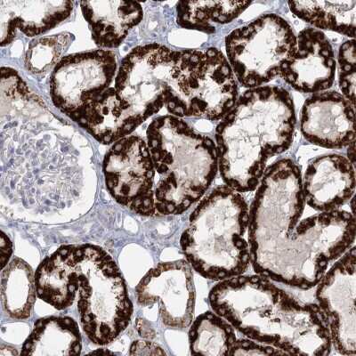 Immunohistochemistry-Paraffin: BPHL Antibody [NBP1-88373]
