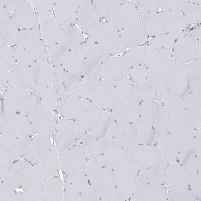 Immunohistochemistry-Paraffin: BPHL Antibody [NBP1-88373]
