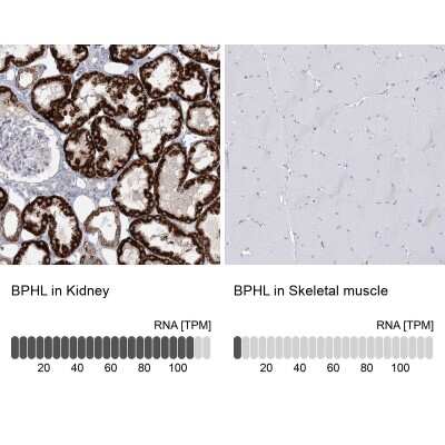 Immunohistochemistry-Paraffin: BPHL Antibody [NBP1-88373]