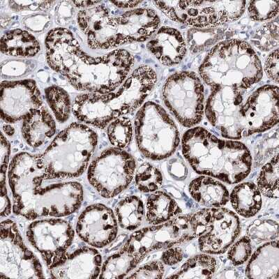 Immunohistochemistry-Paraffin: BPHL Antibody [NBP2-38328]