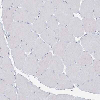 Immunohistochemistry-Paraffin: BPHL Antibody [NBP2-38328]