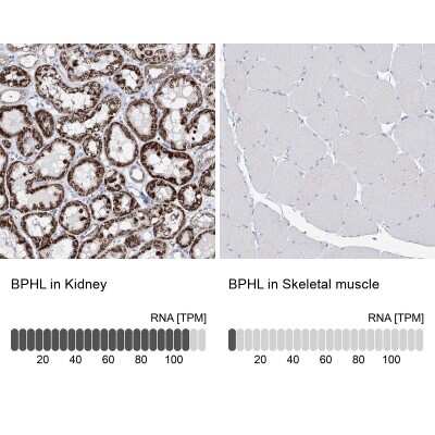 Immunohistochemistry-Paraffin: BPHL Antibody [NBP2-38328]