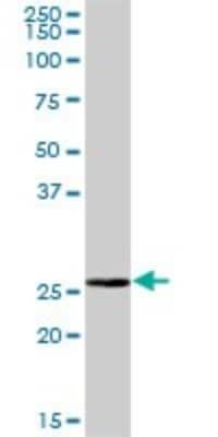 Western Blot: BPHL Antibody [H00000670-B01P]