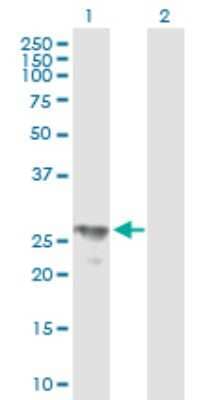 Western Blot: BPHL Antibody [H00000670-B01P]