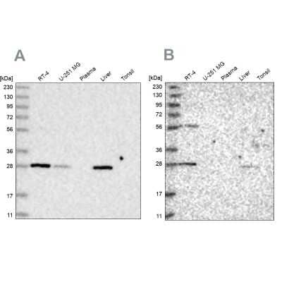 Western Blot: BPHL Antibody [NBP1-88373]