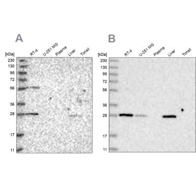 Western Blot: BPHL Antibody [NBP2-38328]