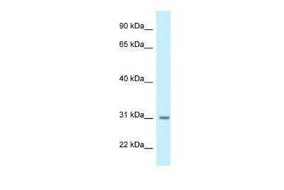 Western Blot: BPHL Antibody [NBP2-87078]