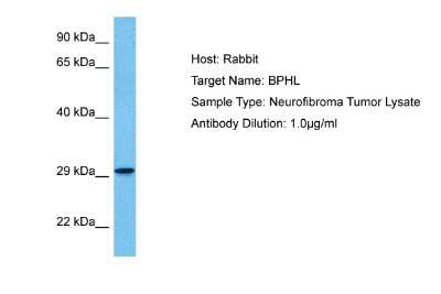 Western Blot: BPHL Antibody [NBP2-87079]