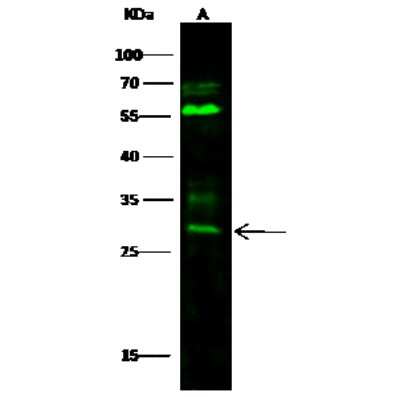 Western Blot: BPHL Antibody [NBP3-00178]