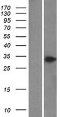 Western Blot: BPHL Overexpression Lysate [NBP2-10227]