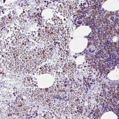 Immunohistochemistry-Paraffin: BPI Antibody [NBP2-37982]