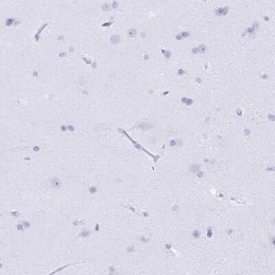Immunohistochemistry-Paraffin: BPI Antibody [NBP2-37982]
