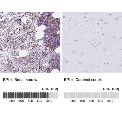 Immunohistochemistry-Paraffin: BPI Antibody [NBP2-37982]