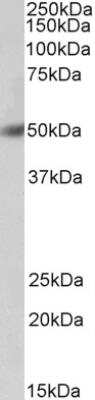 Western Blot: BPI Antibody [NBP2-42503]