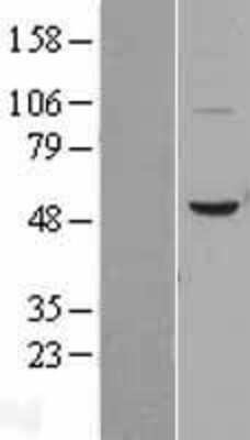 Western Blot: BPI Overexpression Lysate [NBL1-08020]