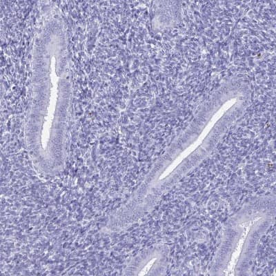 Immunohistochemistry-Paraffin: BPIFA3 Antibody [NBP2-31864]
