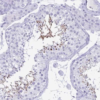 Immunohistochemistry-Paraffin: BPIFA3 Antibody [NBP2-31864]