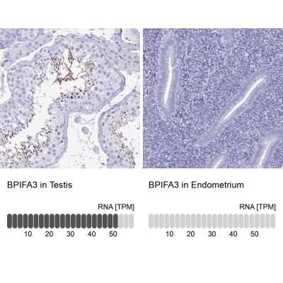 Immunohistochemistry-Paraffin: BPIFA3 Antibody [NBP2-31864]