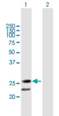 Western Blot: BPIFA3 Antibody [H00128861-B01P]