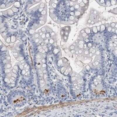 Immunohistochemistry-Paraffin: BPIFB1 Antibody [NBP1-90022]