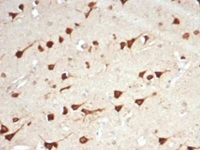 Immunohistochemistry-Paraffin: BPIFB1 Antibody (LPLUNC1/7059R) [NBP3-13812]