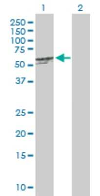 Western Blot: BPIFB1 Antibody [H00092747-B01P]