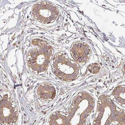 Immunohistochemistry-Paraffin: BPIFB3 Antibody [NBP2-14554]