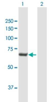 Western Blot: BPIFB4 Antibody [H00149954-B01P]