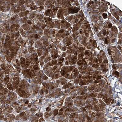 Immunohistochemistry-Paraffin: BPIL1 Antibody [NBP2-14358]